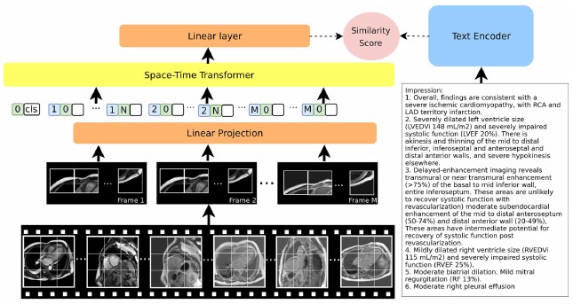 Contrastive Language Image Pretraining for a Cardiac Magnetic Resonance Image Embedding with Zero-Shot Capabilities overview